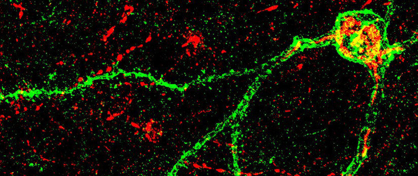 Neuron microscopy 